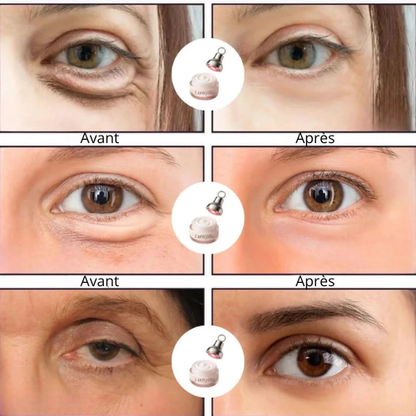 Resilience Rebuilder — LED Radiance Eye Cream